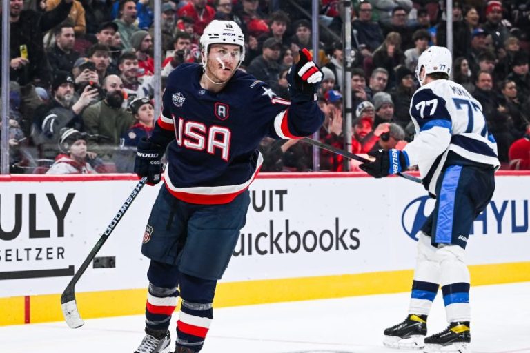 Injured USA 4 Nations star ‘feeling better,’ wants redemption